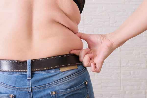 back fat reduction Shepperton Green from Lipo sculpt find the best option for you!