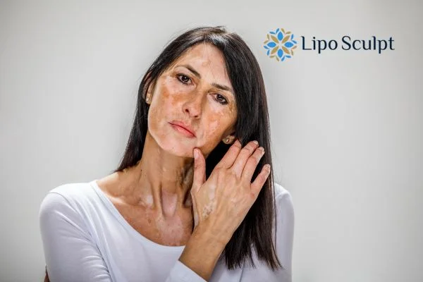 Concerned about a skin spot Shepperton Green? Have new, changing or unusual marks checked by an appropriate healthcare professional before considering cosmetic treatment.