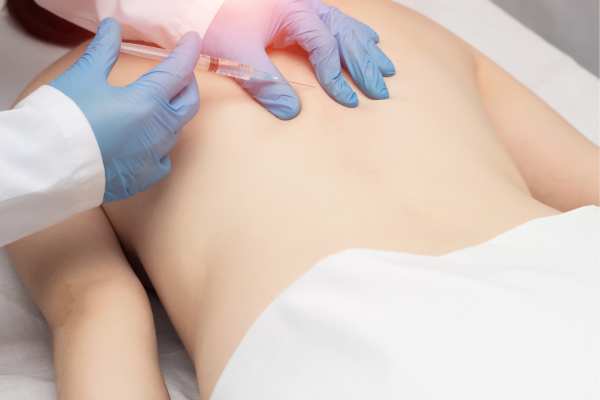 Lipo Sculpt will offer the best fat back reduction Shepperton Green call us today!