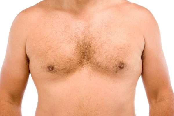 Fat freezing for moobs reduction treatment Shepperton Green book in today!