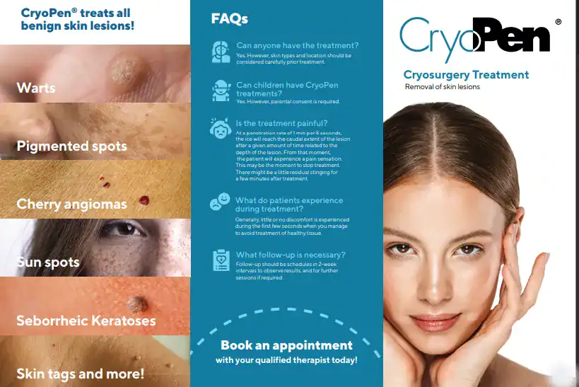 Benefits of Cryopen for seborrheic keratosis Removal Treatment Shepperton Green