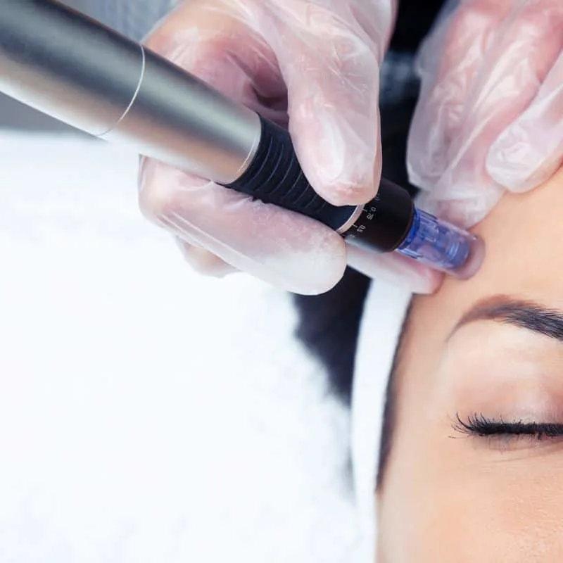 Complete Skin Tightening Prices Shepperton Green